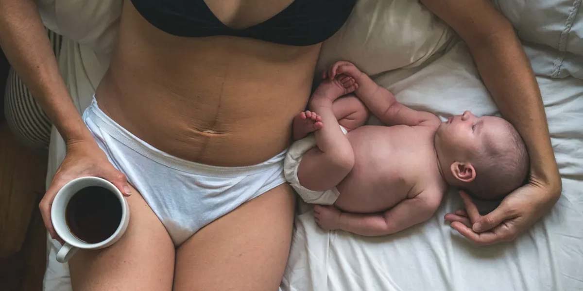 Mommy pooch in women after birth is caused by diastasis in the recti of the abdomen