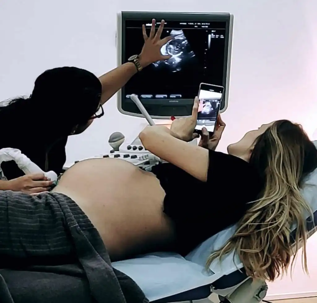 physiotherapy session with ecography as biofeedback for pregnant women